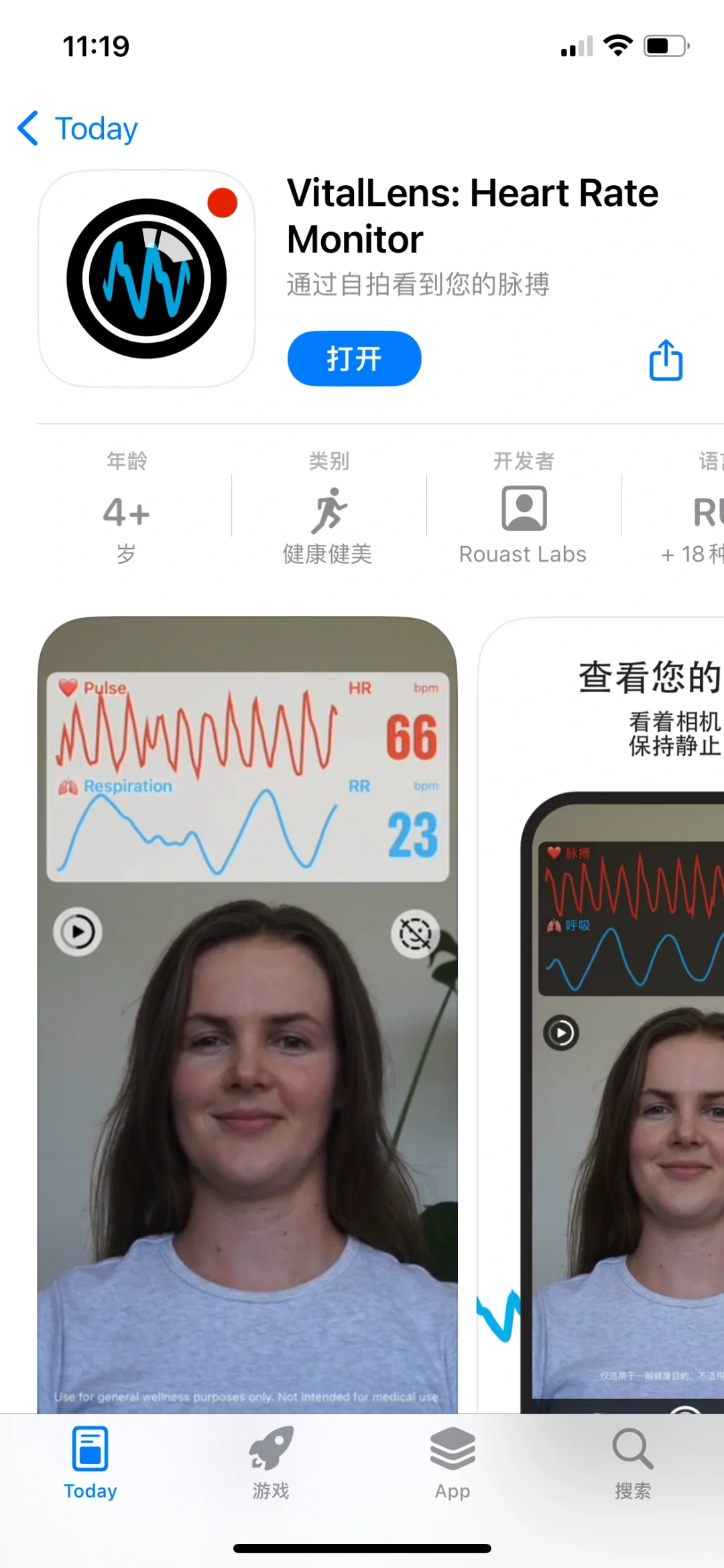 VitailLens,内购限免啦!速度拿下