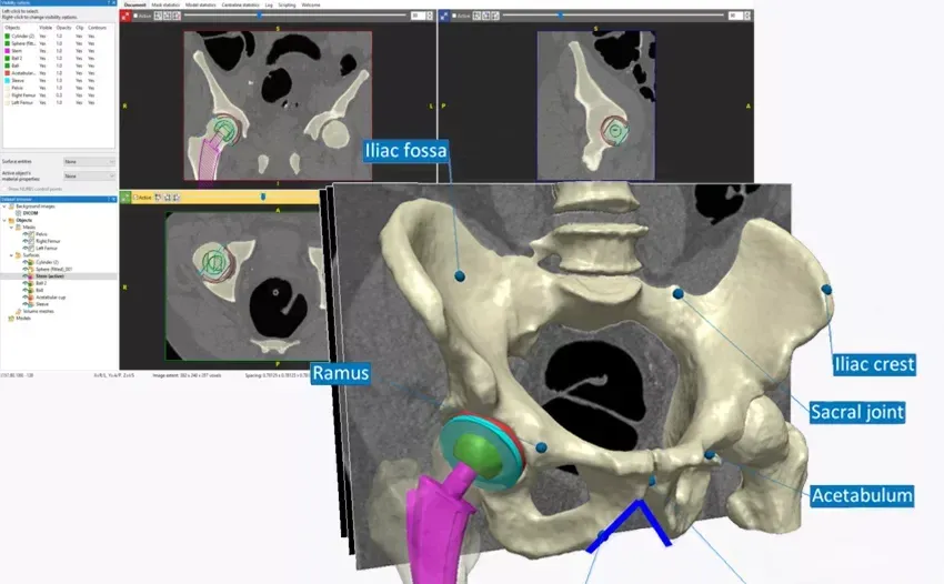 comet dragonfly 2025.1 3D重建