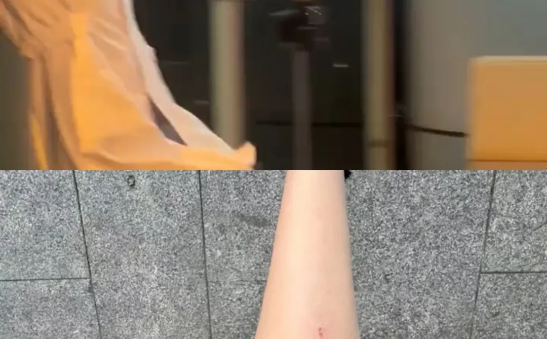 短剧也成高危职业！这确定不是故意伤害吗？