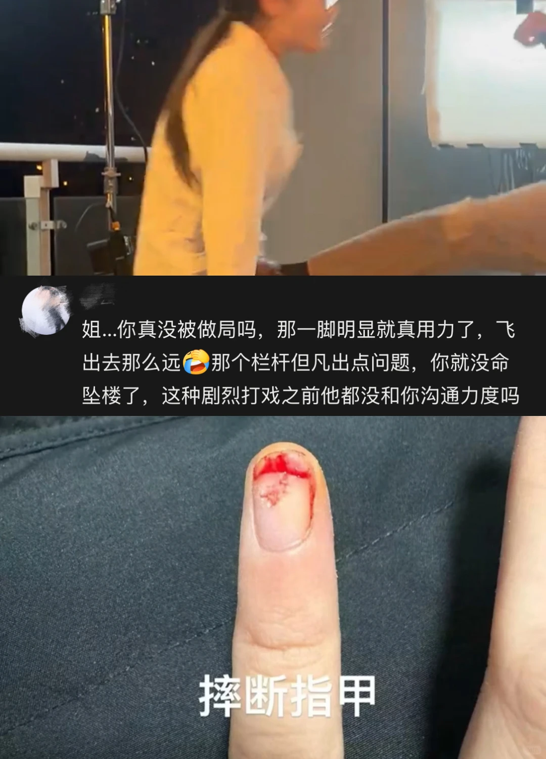 短剧也成高危职业！这确定不是故意伤害吗？