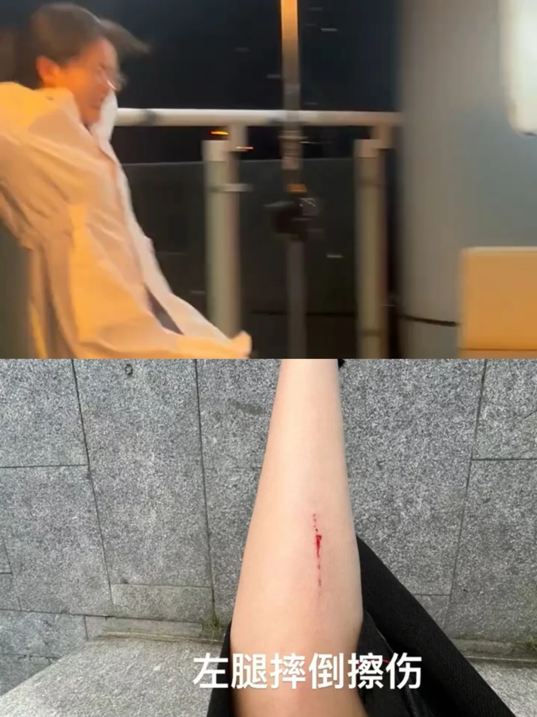 短剧也成高危职业！这确定不是故意伤害吗？