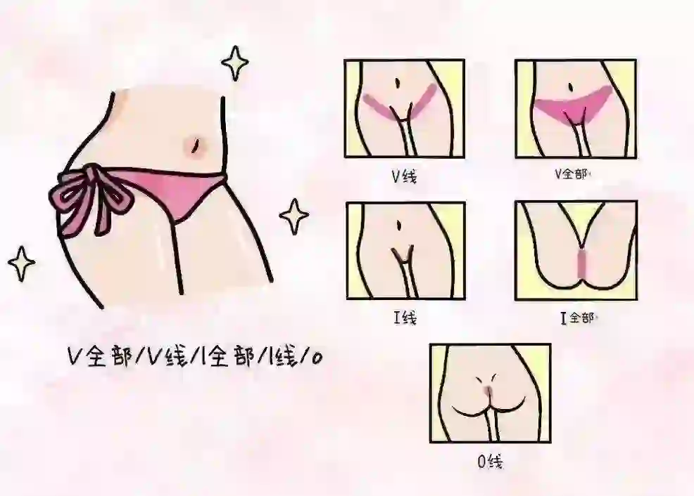 沈阳比基尼脱毛