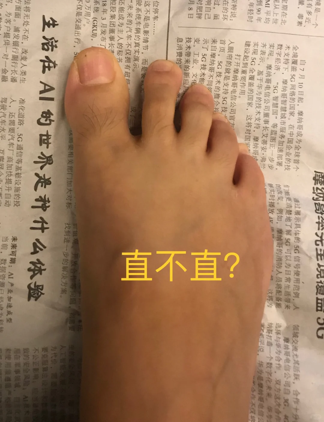 如何拍摄标准的拇外翻外观照片