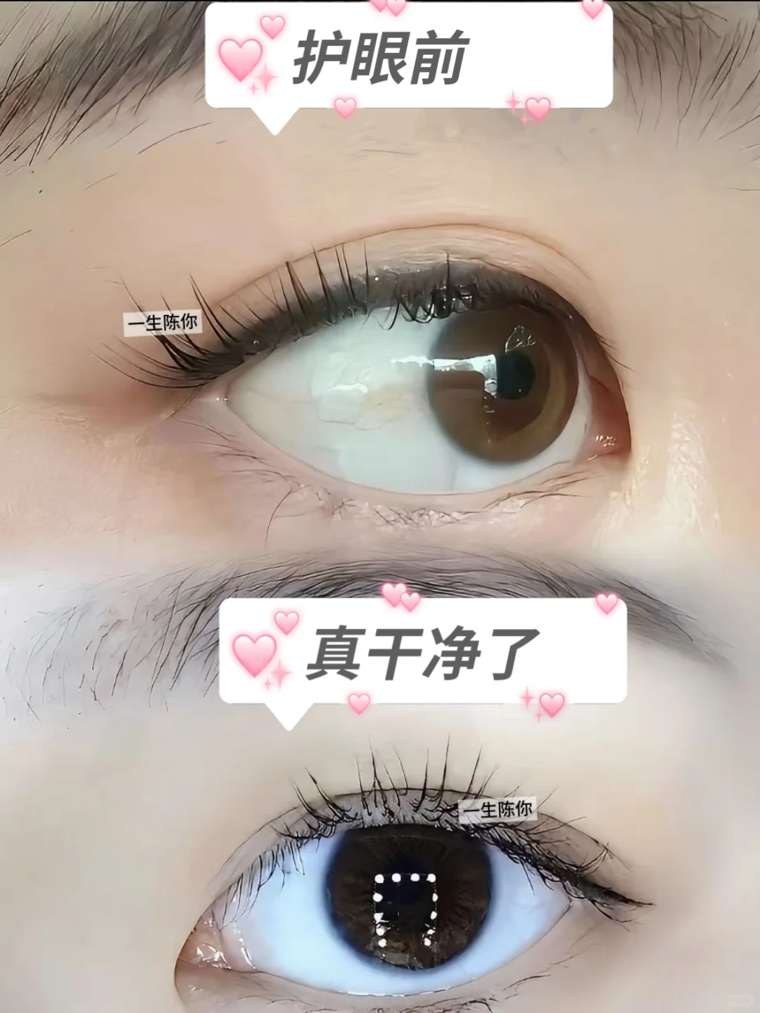 逢人就夸🌟！被追问爆的绝美眼珠水！