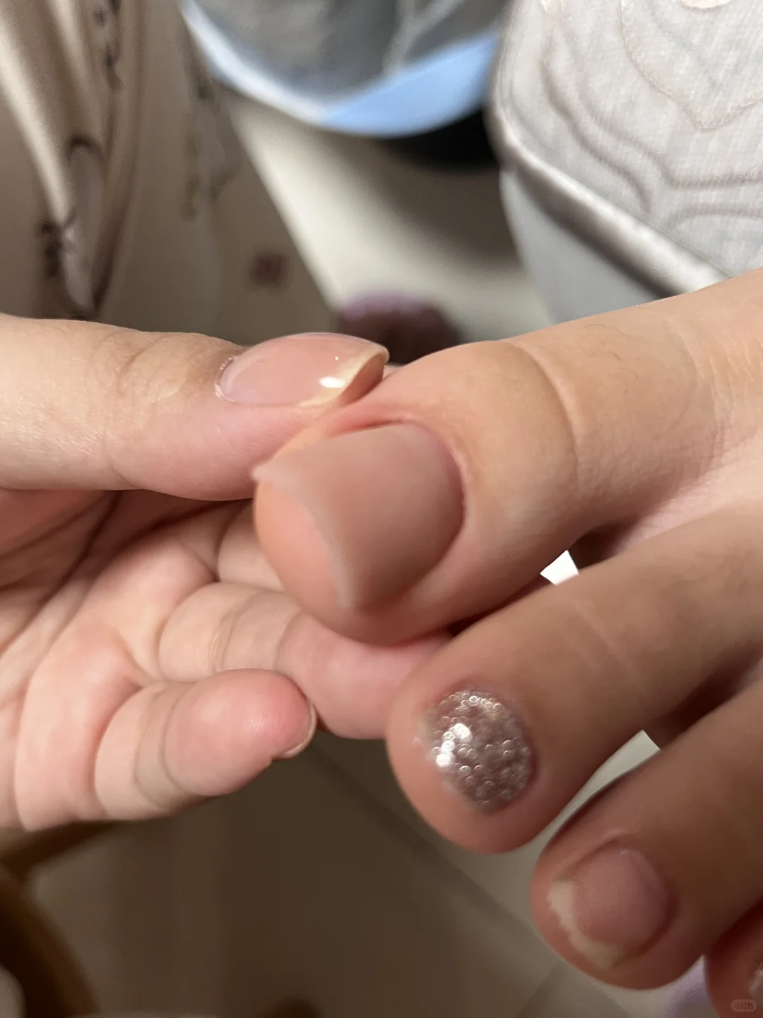 初一的妹妹说她有脚趾羞耻症…