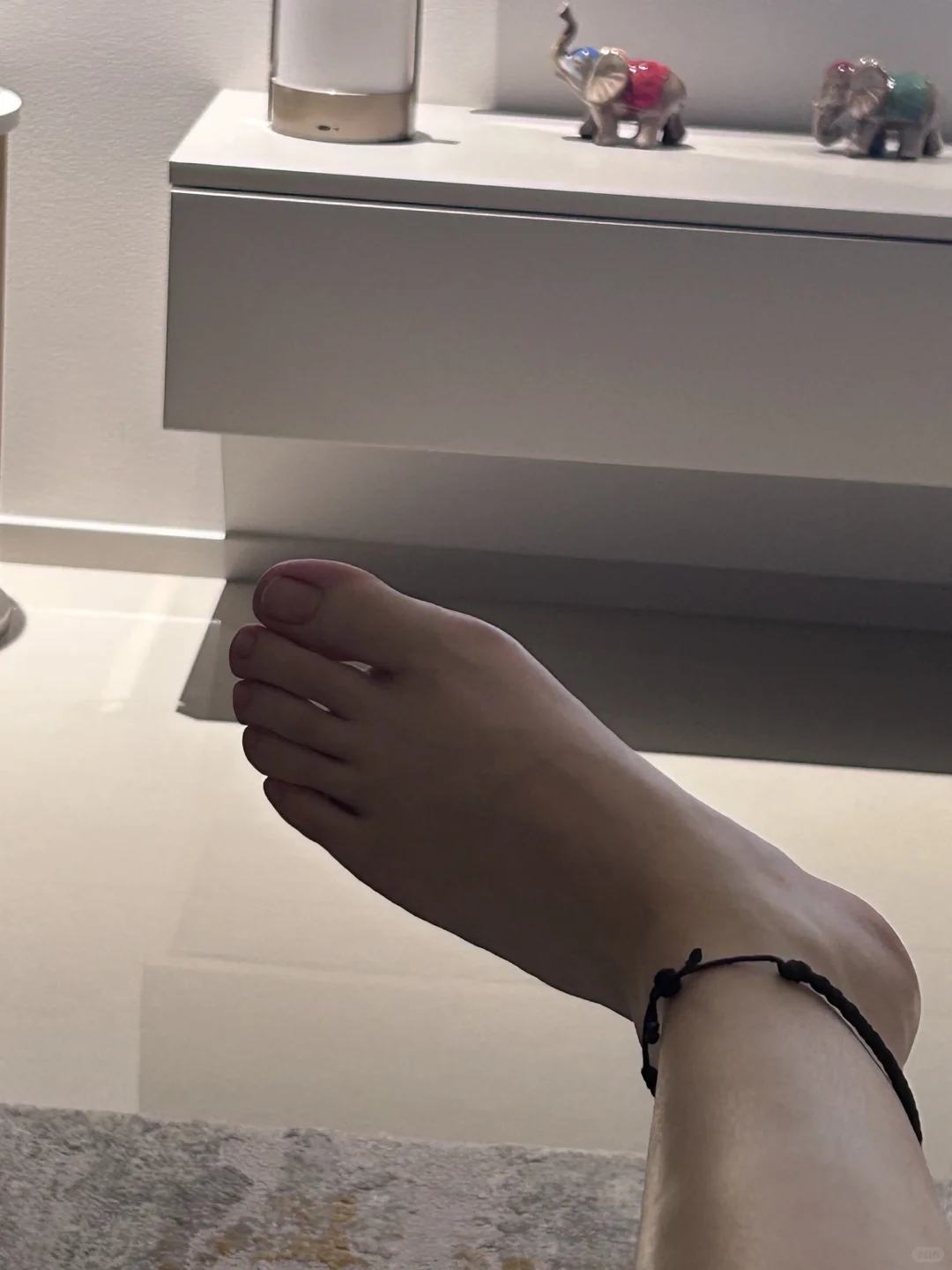 晚上明显会肿
