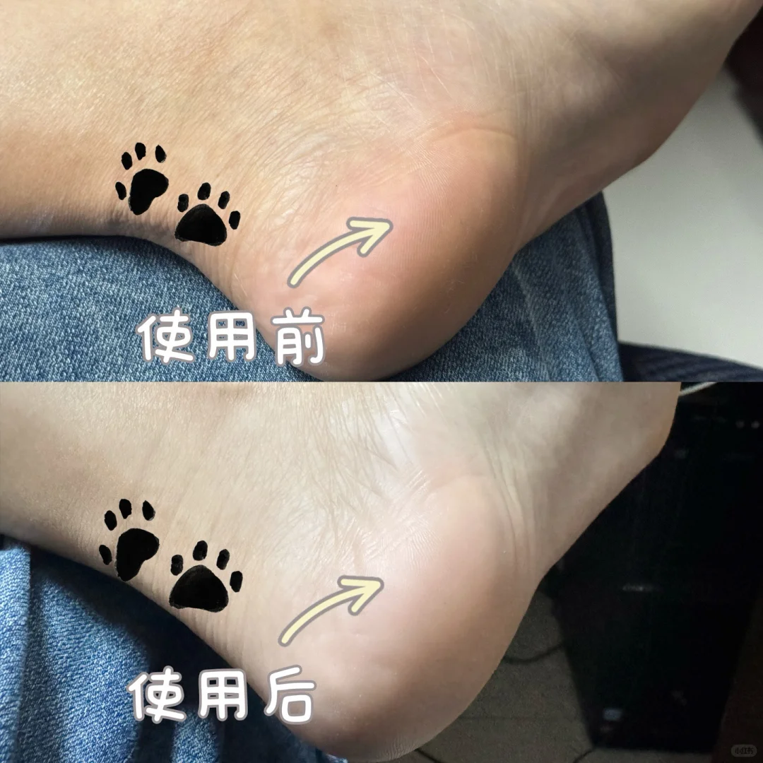 在家轻松打造丝滑美足，从此自信露脚！