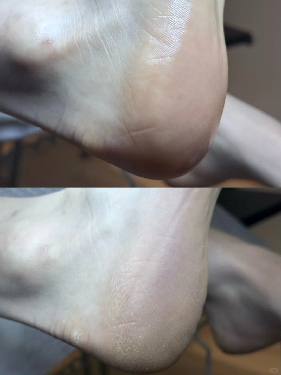 live版美足来啦！解锁上海足部护理天花板