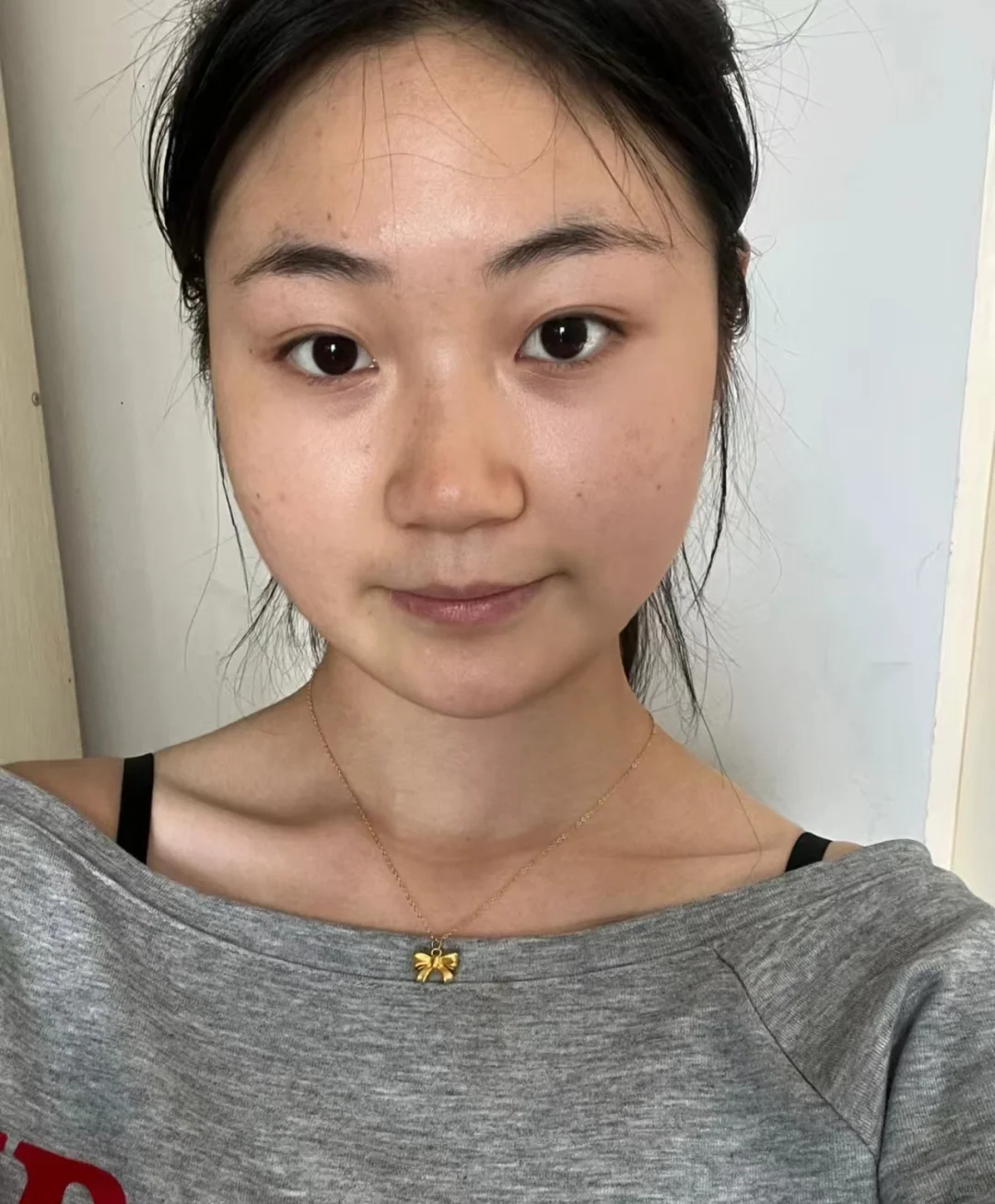 和我一个脸型的就别去做瘦脸针了。。