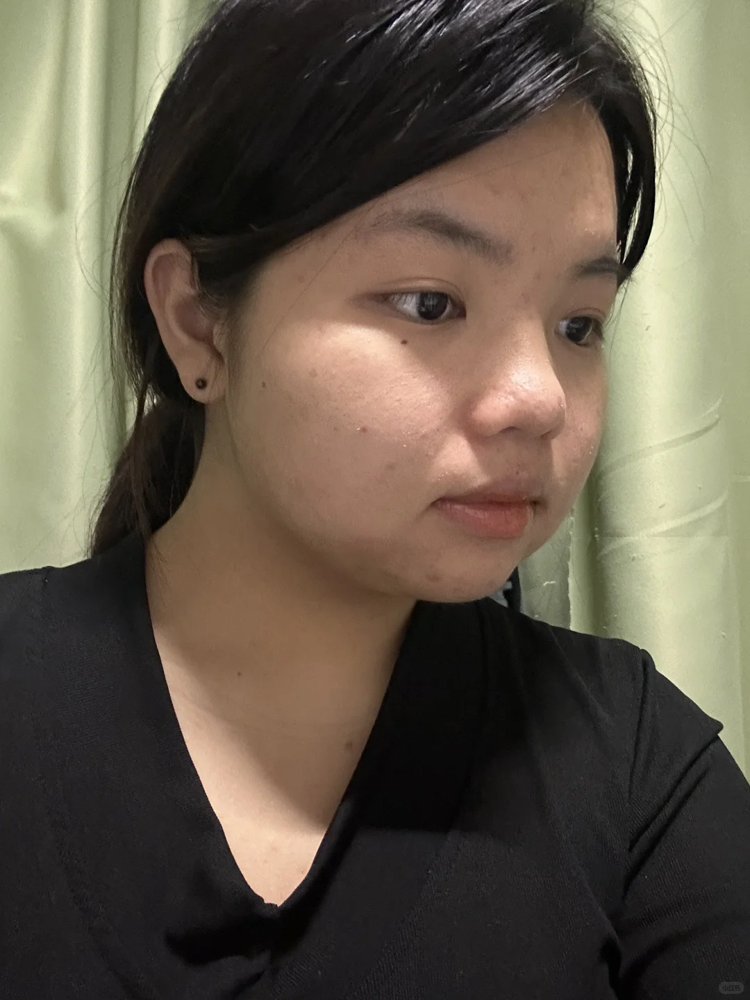 右滑看女大纯靠饮食瘦15斤脸部对比