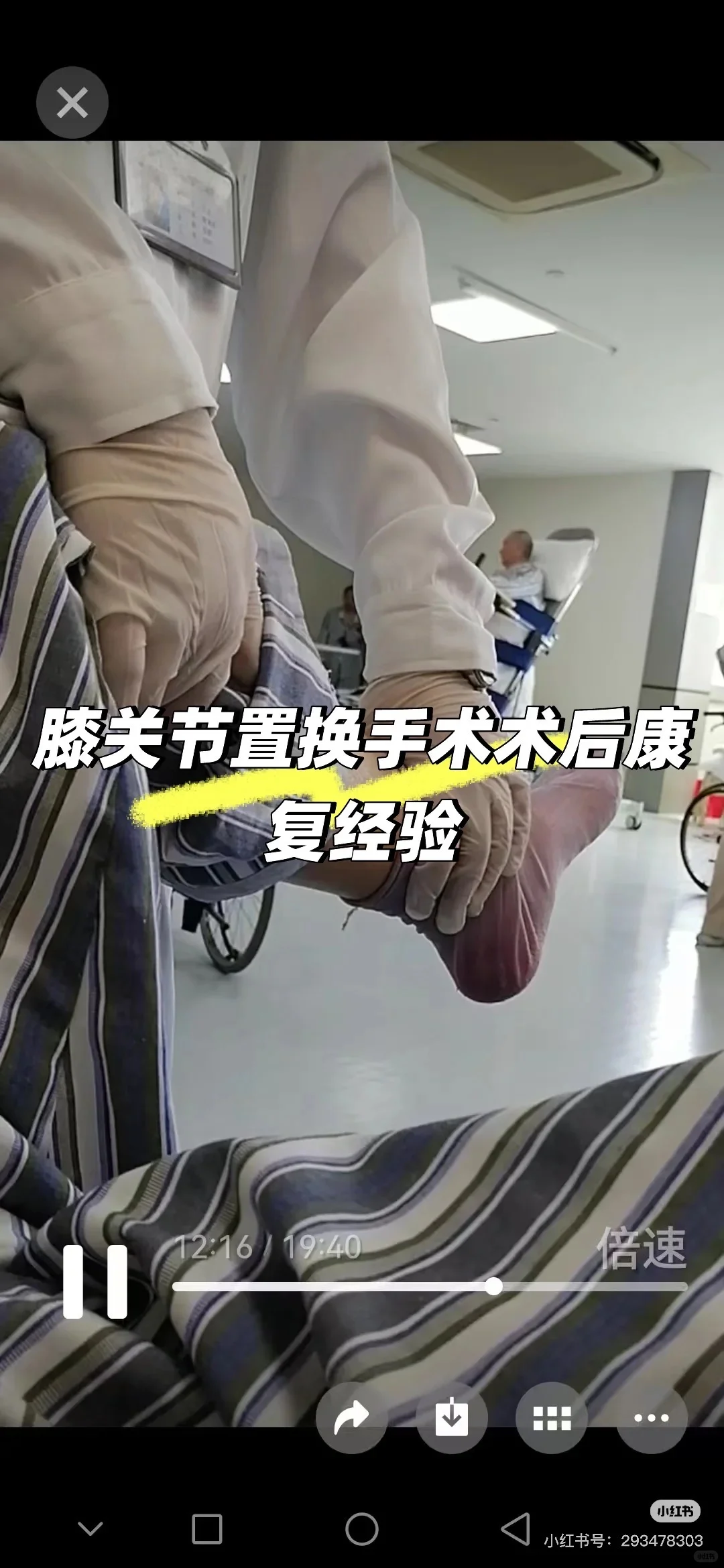 膝关节置换手术经验纯干货！！！分享（2）
