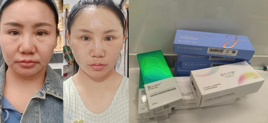 一年了脸蛋还是这么嘭弹✨