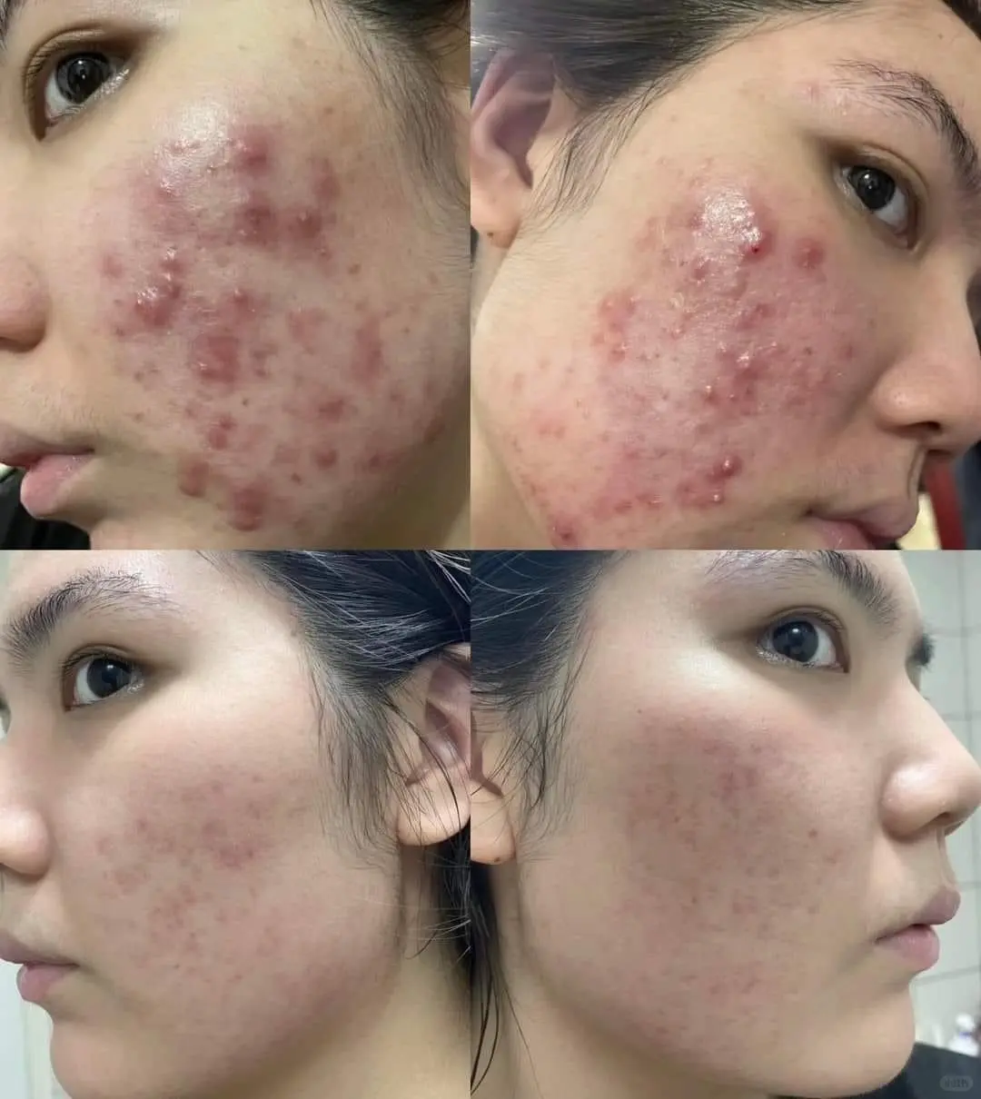 💖台湾天丽保养品💖