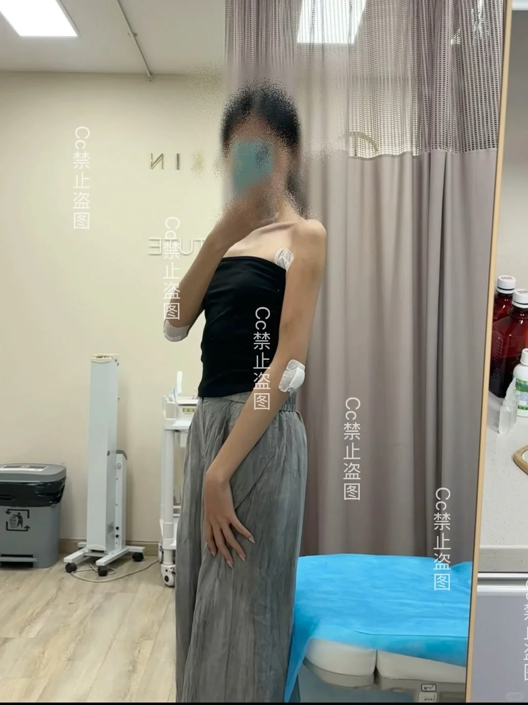 手臂➕后背 对比