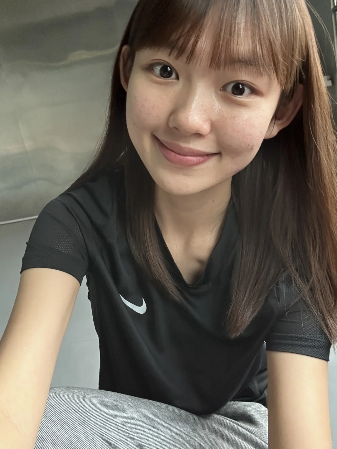 皮肤不好不影响我漂亮