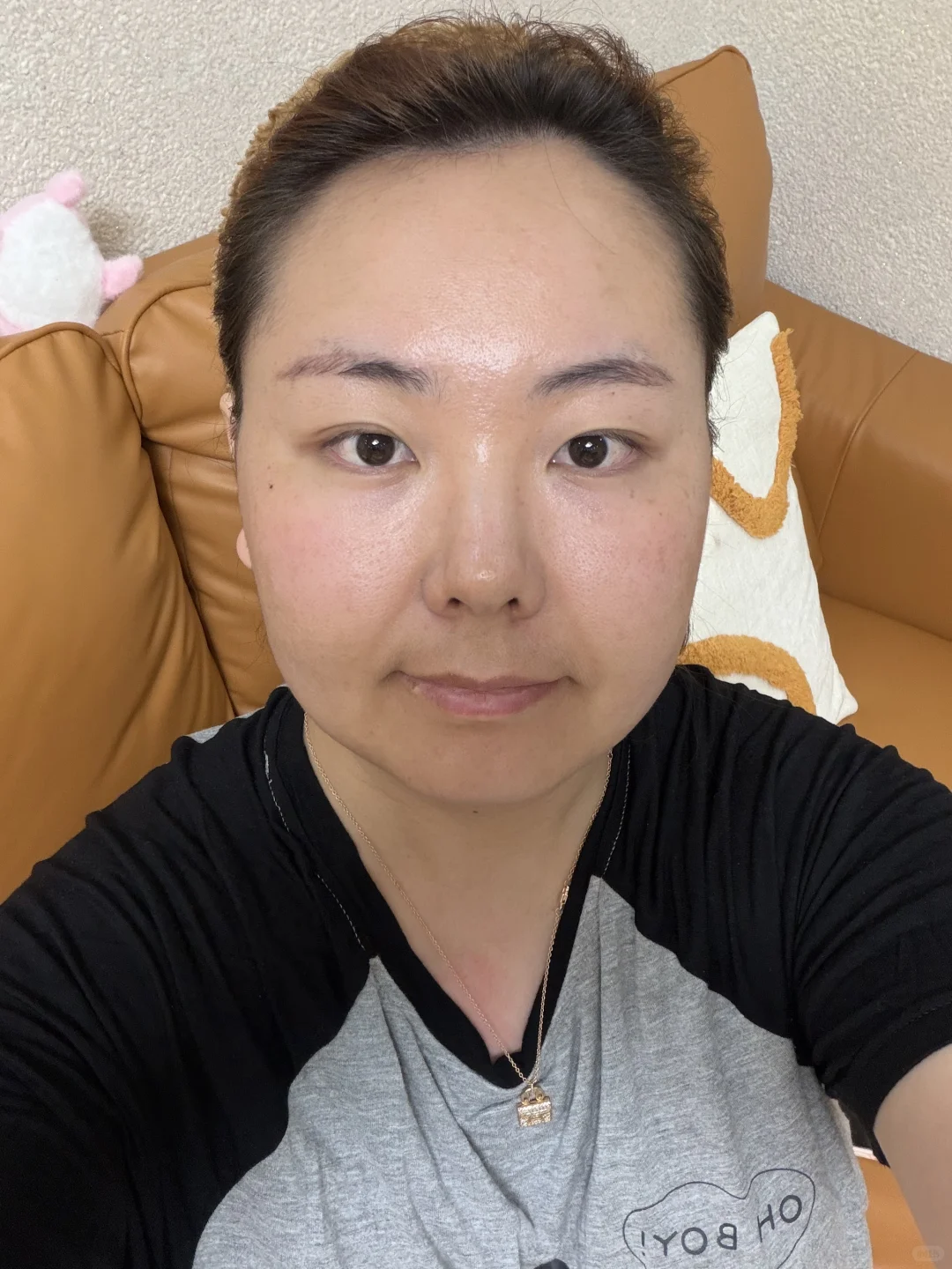 32岁 你的素颜皮肤状态是哪样