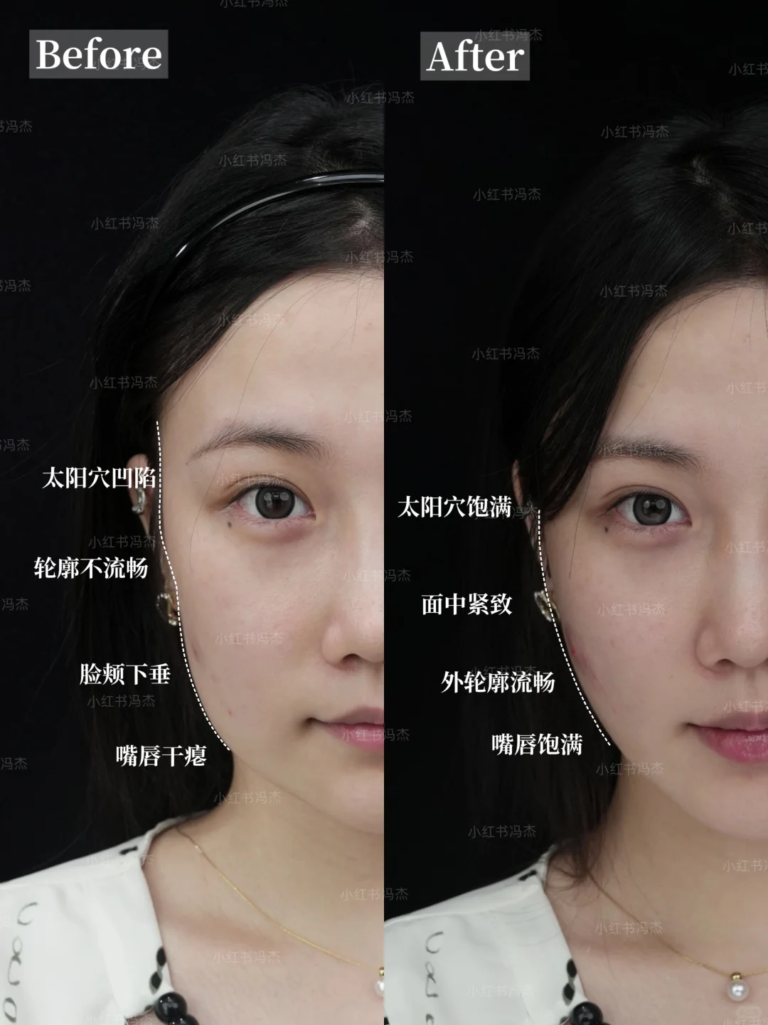 脸歪!嘴斜!大小脸!已上岸!