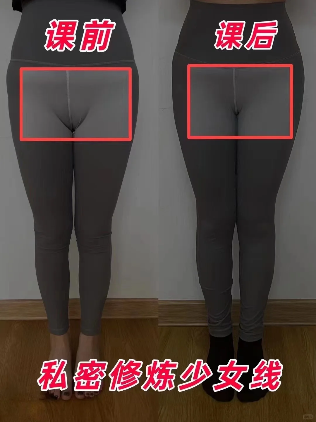 尴尬线 耻骨股个大包 为什么