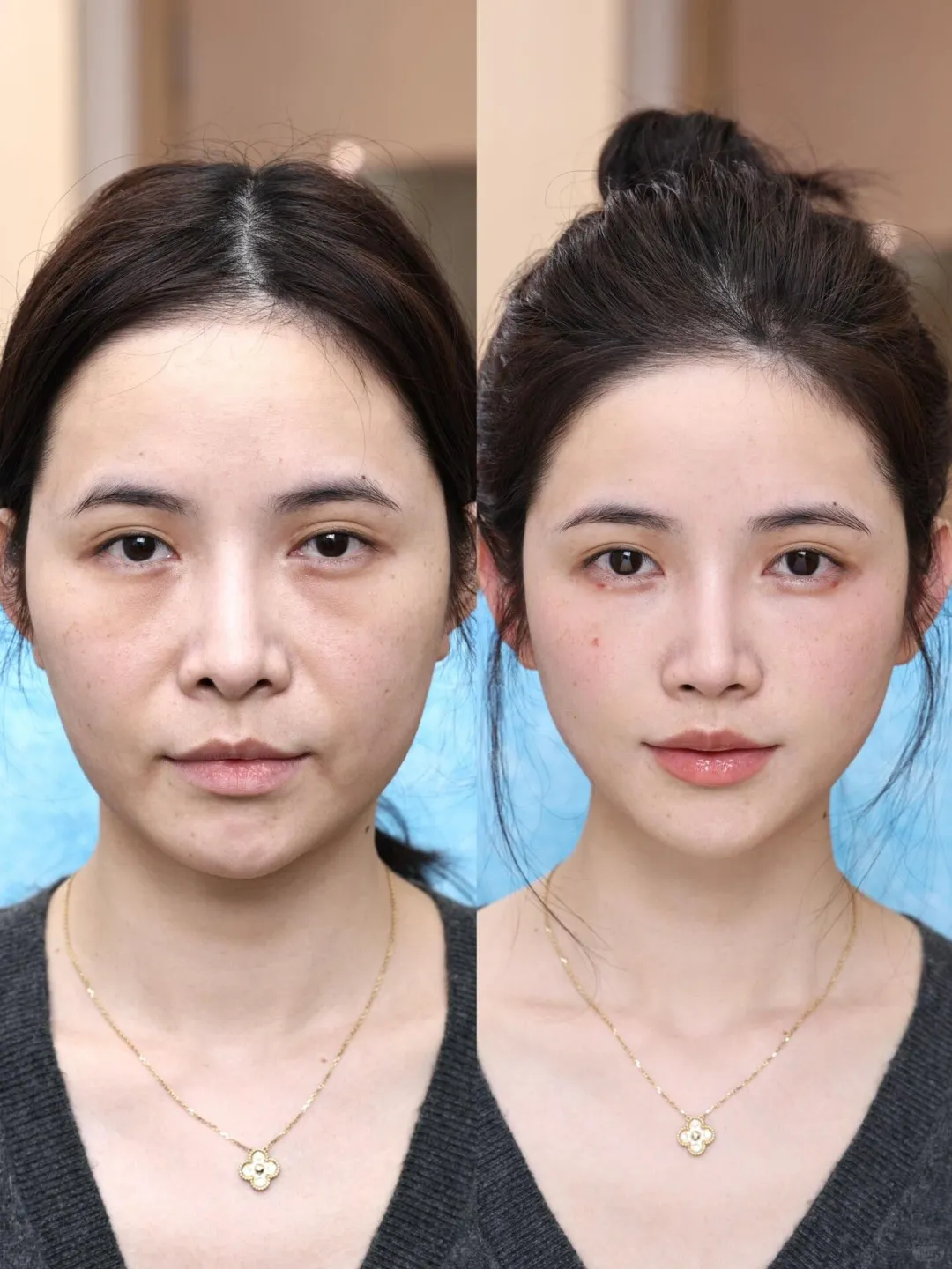 垮脸救星！妈生感紧致小脸~