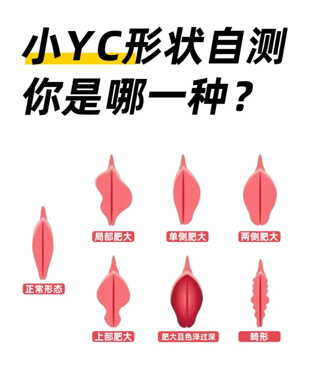 不懂就问，女生小花园形态有几种?