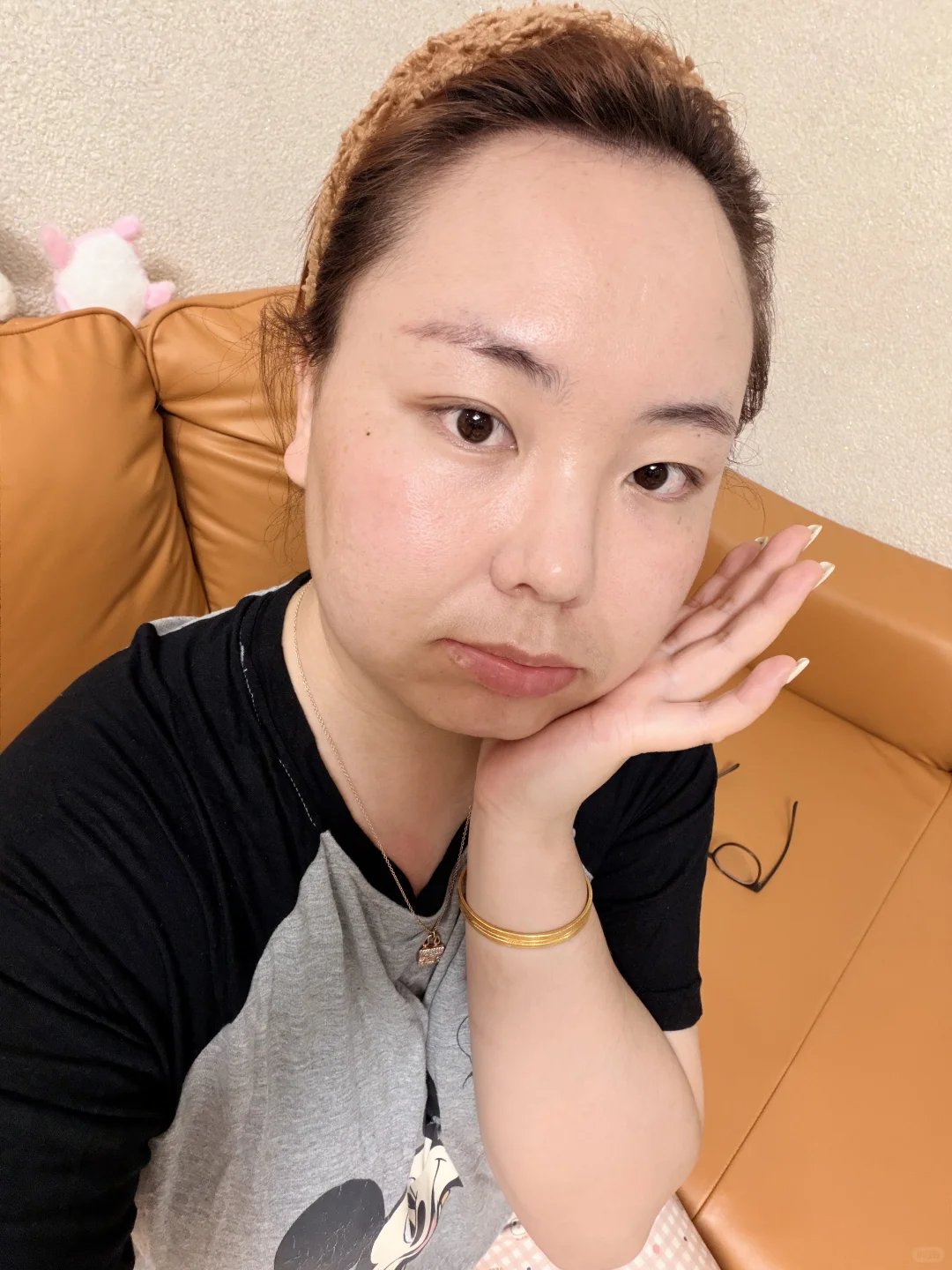 32岁 你的素颜皮肤状态是哪样