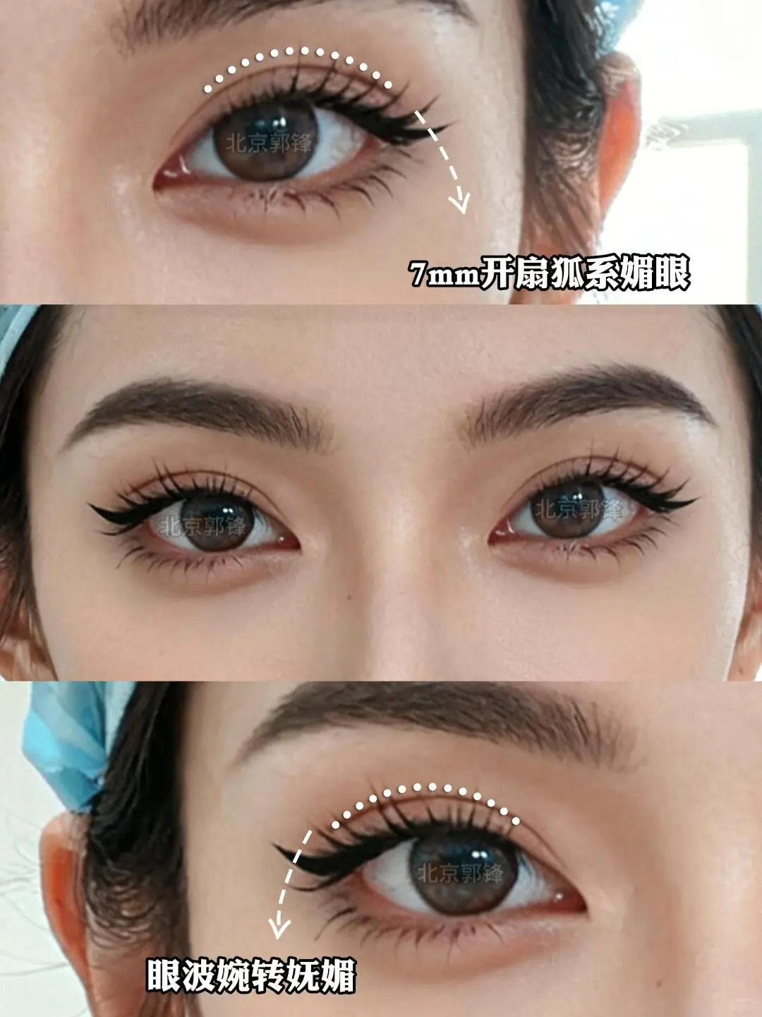北京双眼皮丨狐系媚眼 眼波婉转妩媚