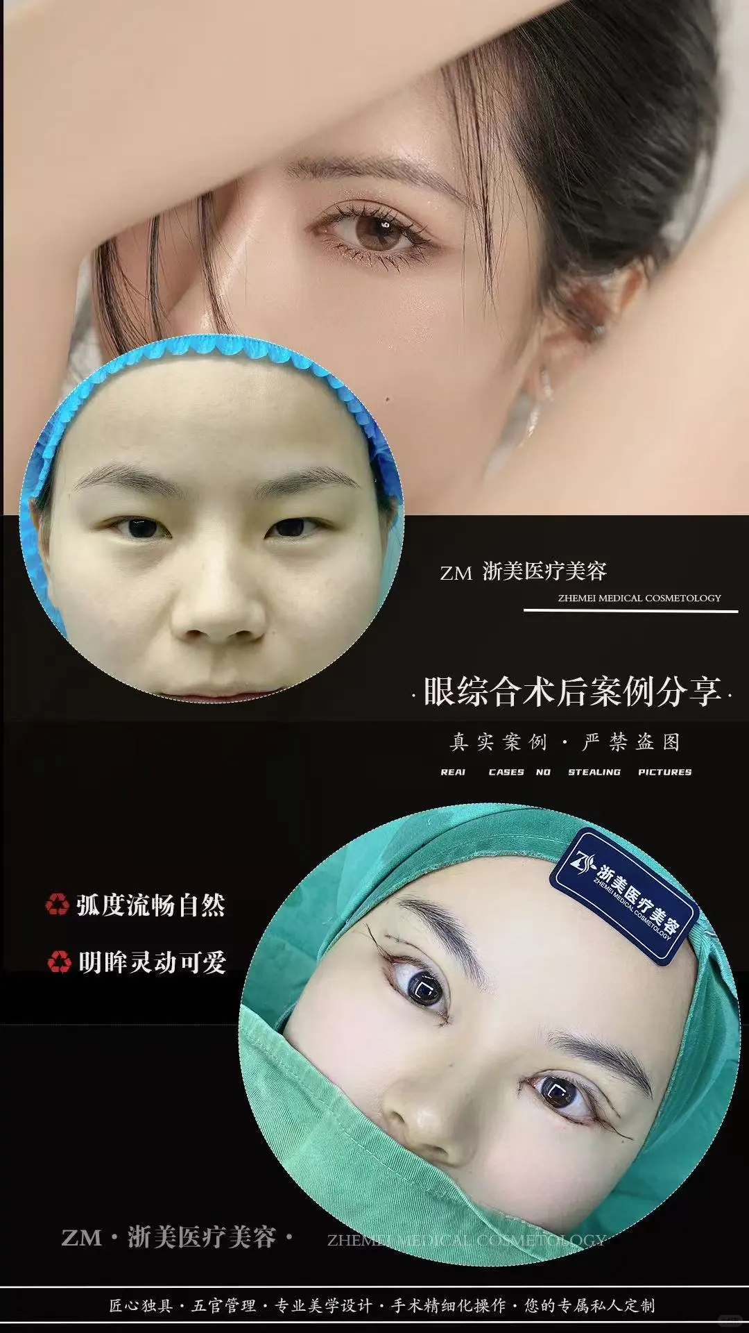 眼综合案例