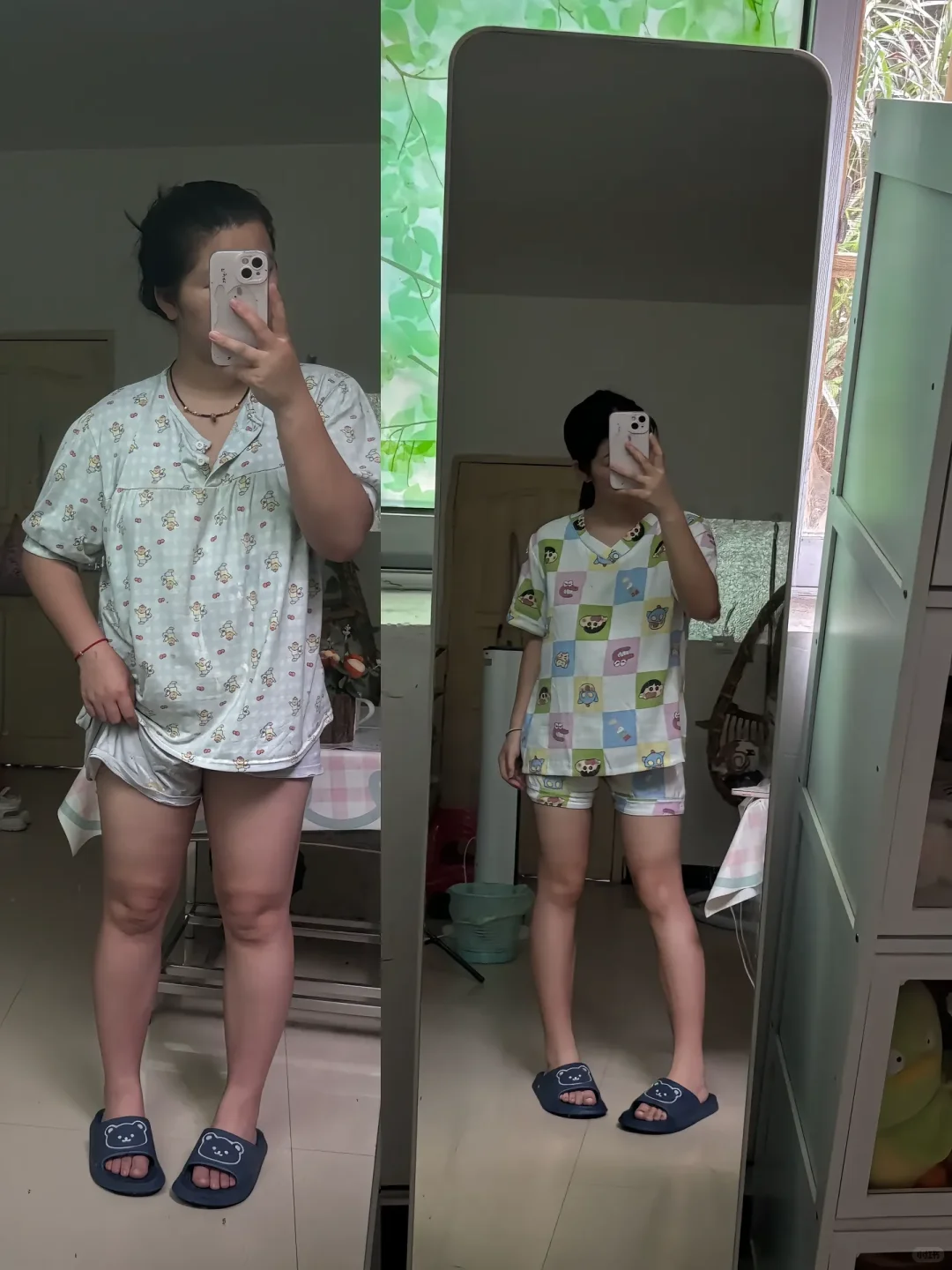 昆明|中医埋线减肥真的有用吗⁉️