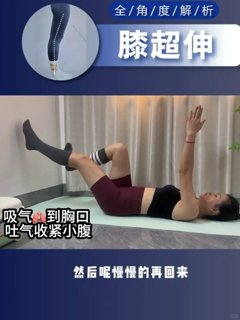 膝超伸的隐形帮手！｜这袜子穿了就不想脱🔥