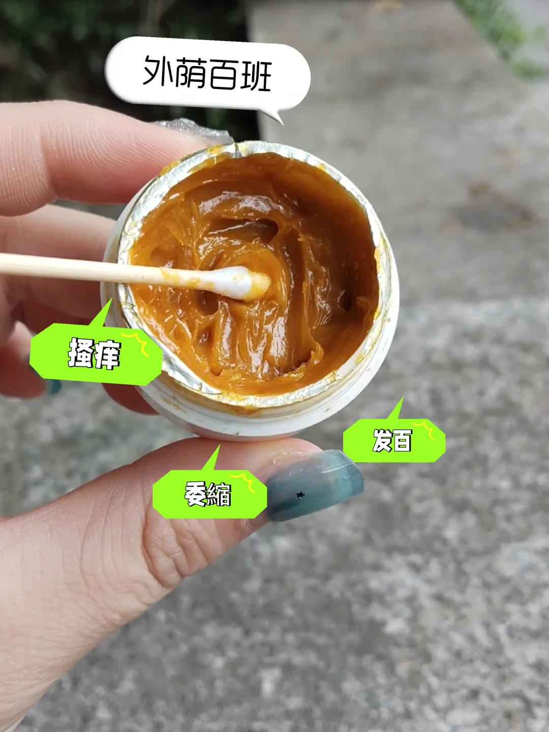 外荫百班越痒越抓？试试它！