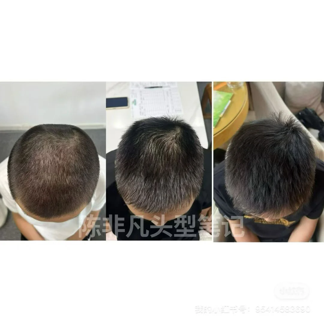 扁头不仅仅是女生的痛，同时也是一部分男生