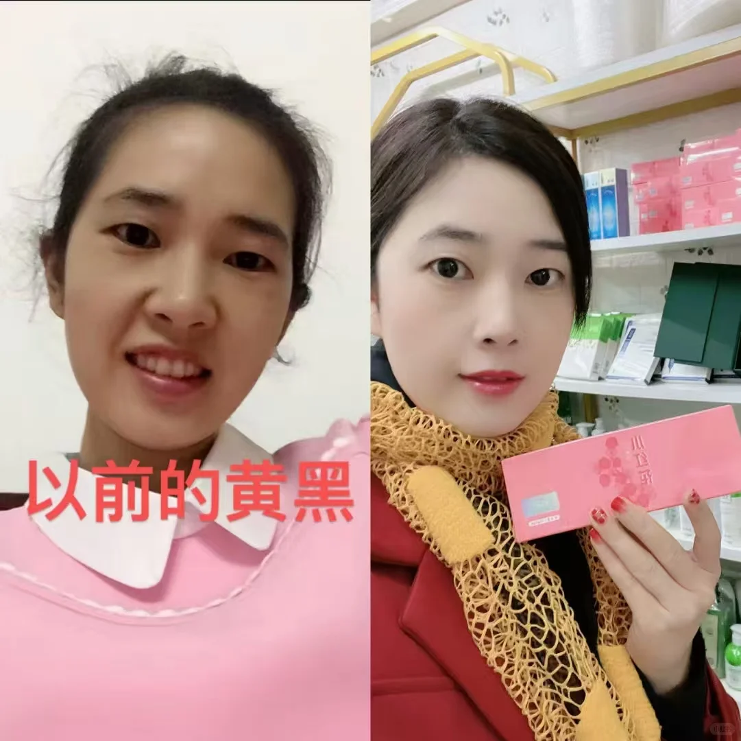 今天起,做个天生丽质可爱漂亮的女人~