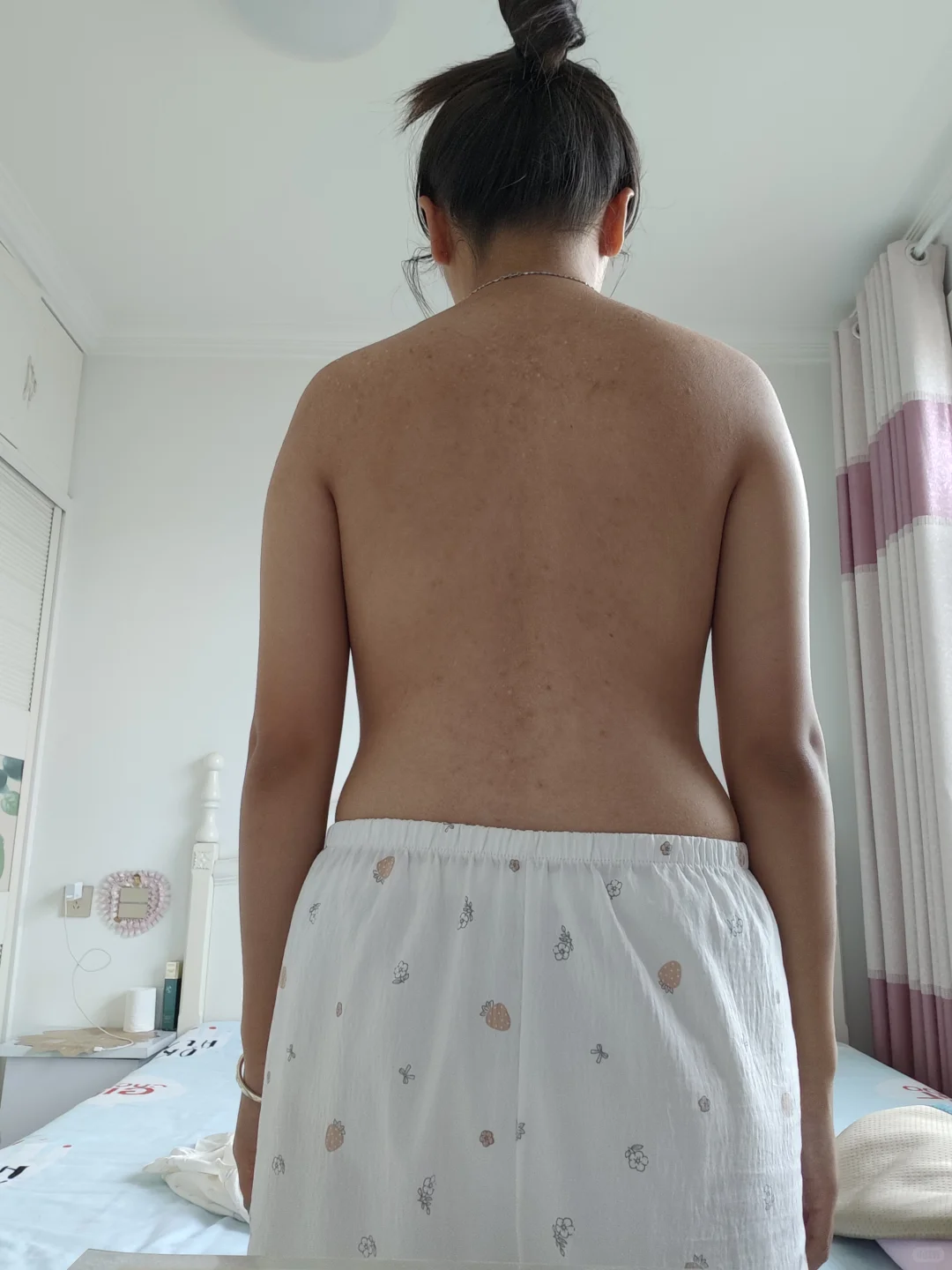小红们帮我看看我的体态问题