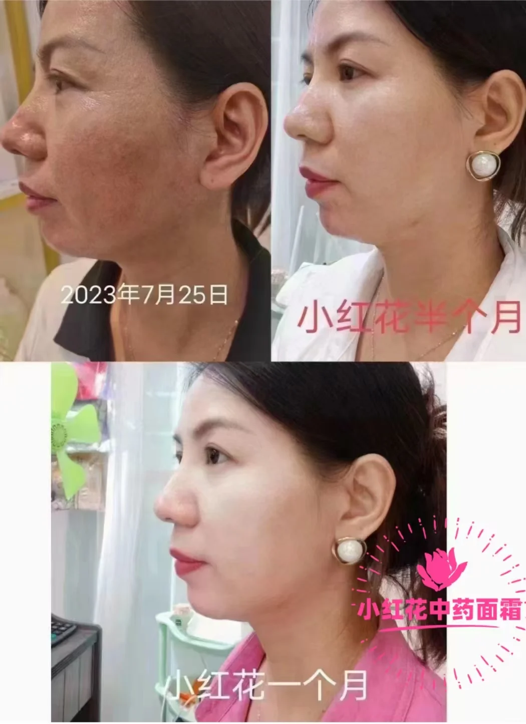 今天起,做个天生丽质可爱漂亮的女人~