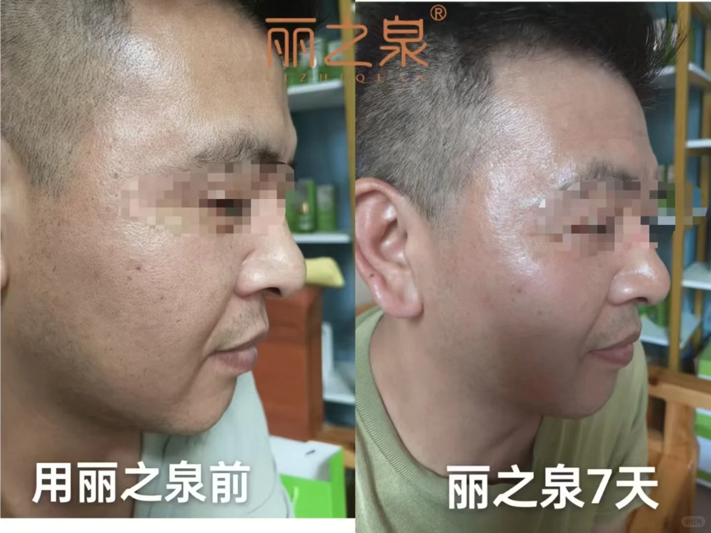 想要“换脸式”护肤吗？赶紧尝试丽之泉护肤套