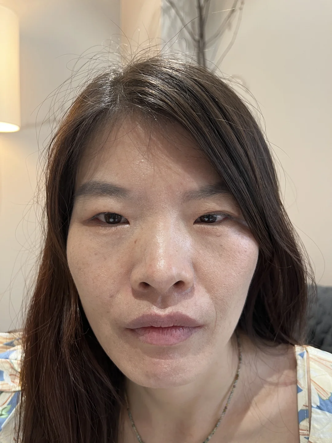 有没有专业人士看下还有救吗