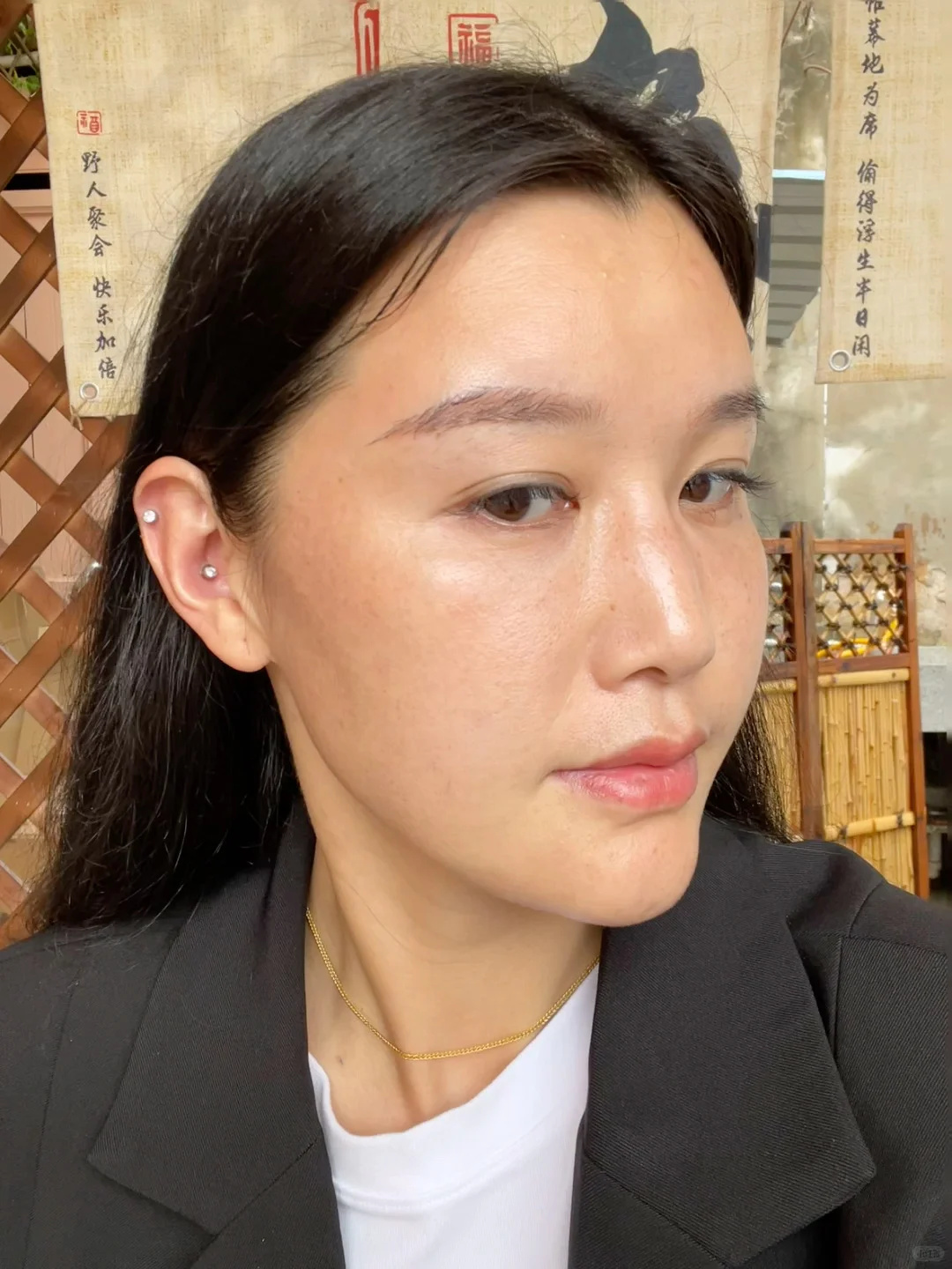 40岁骨相美女拯救黄褐斑day6