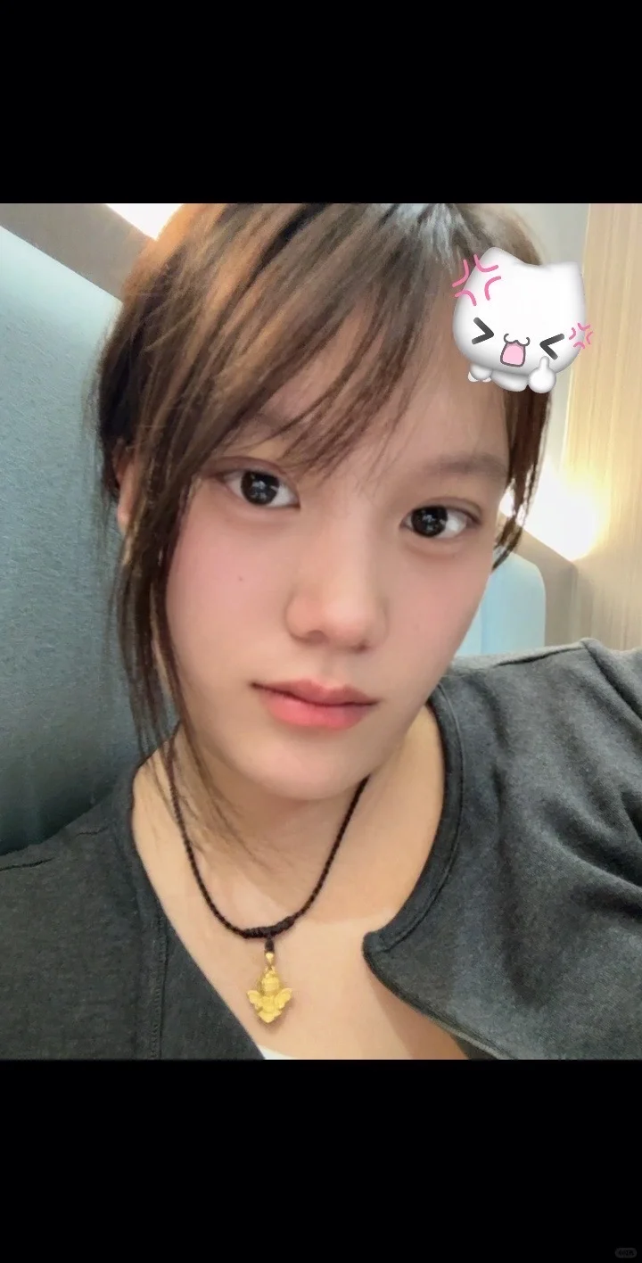 做了双眼皮感觉整个人都变了