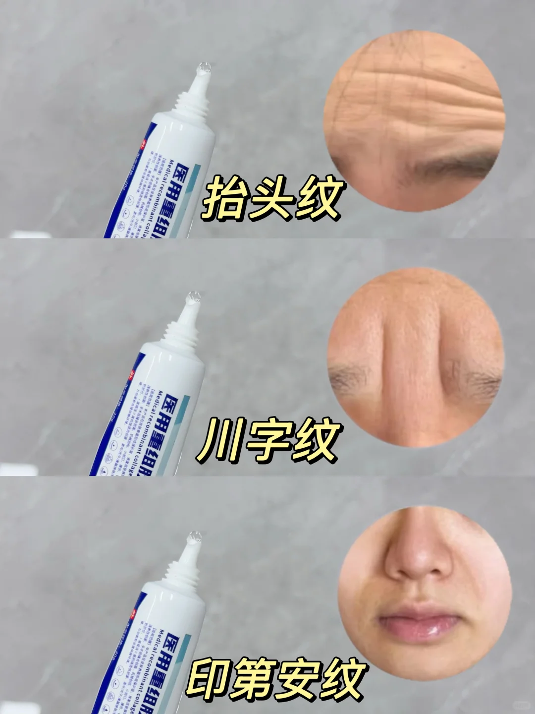 不删,脸上抬头纹别慌👀这!