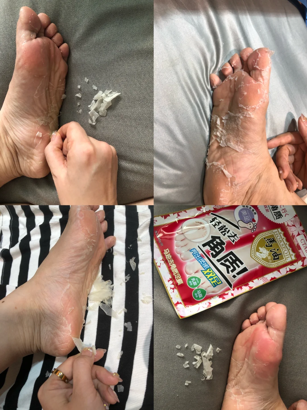 谁懂!🦶死皮角质kuku掉‼️