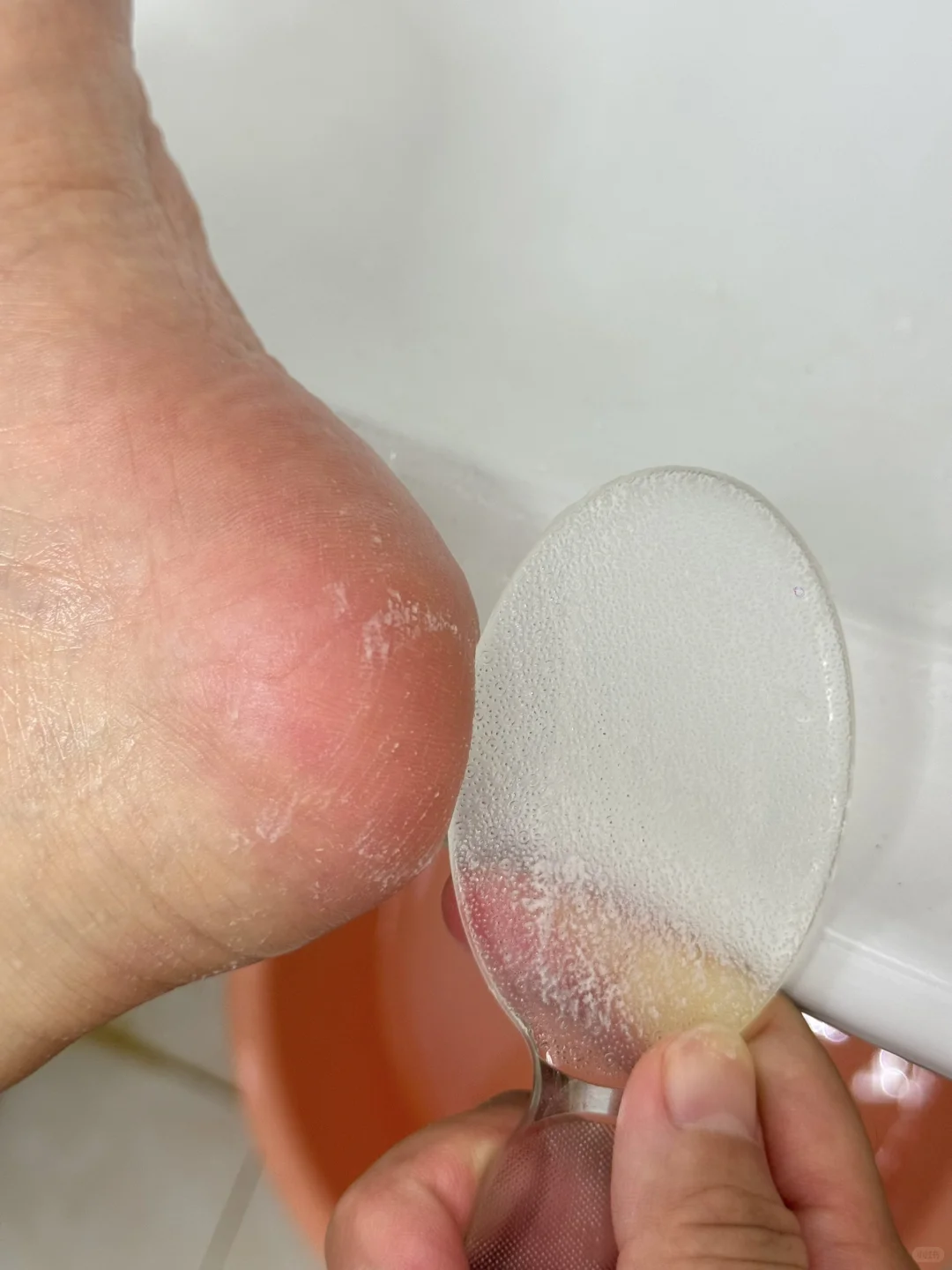 告别干裂脚!激动鼠了~