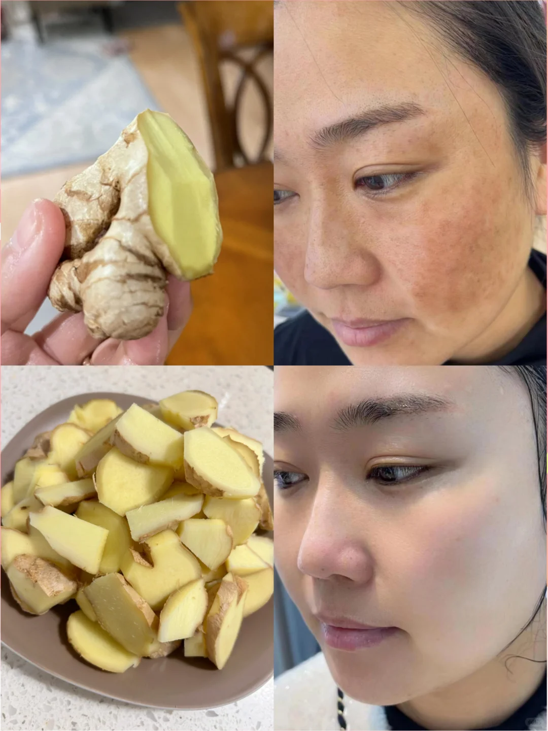 每周姜片水洗脸，斑不见了