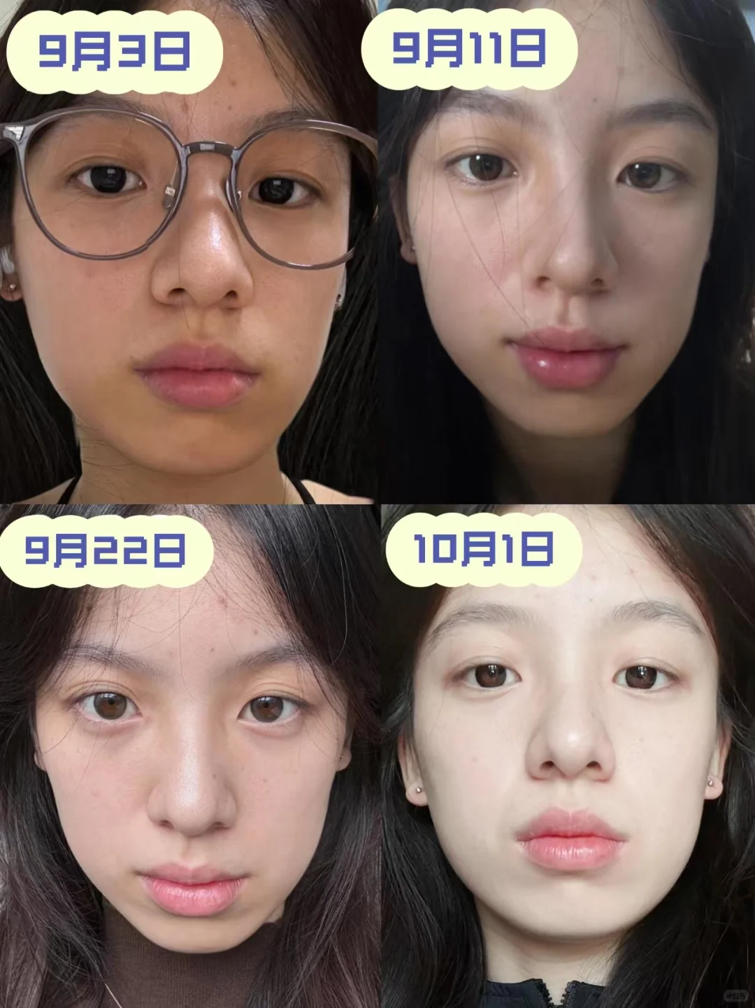 差皮肤真的会封印美貌