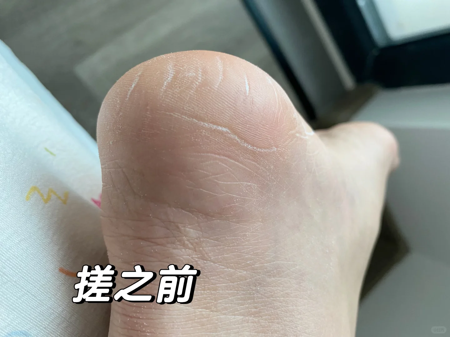 邪修🐮物❗️直接封神❗️糙脚跟搓完嫩到飞起✨