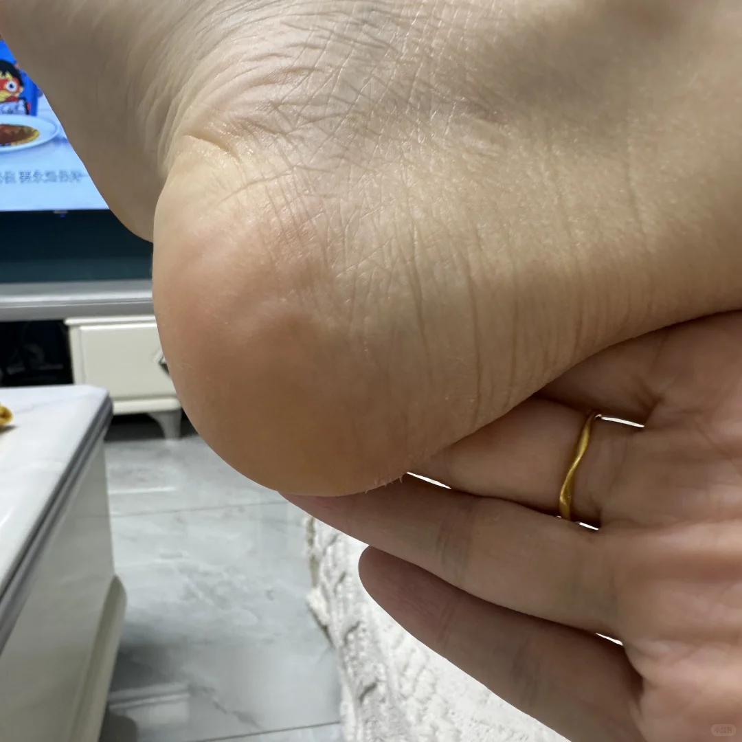 姐妹😭8.8💰买的搓脚板效果美晕我!!