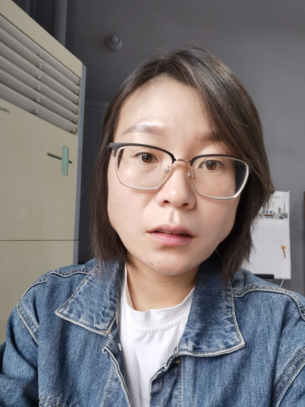 瘦脸针记录，献给姐妹们