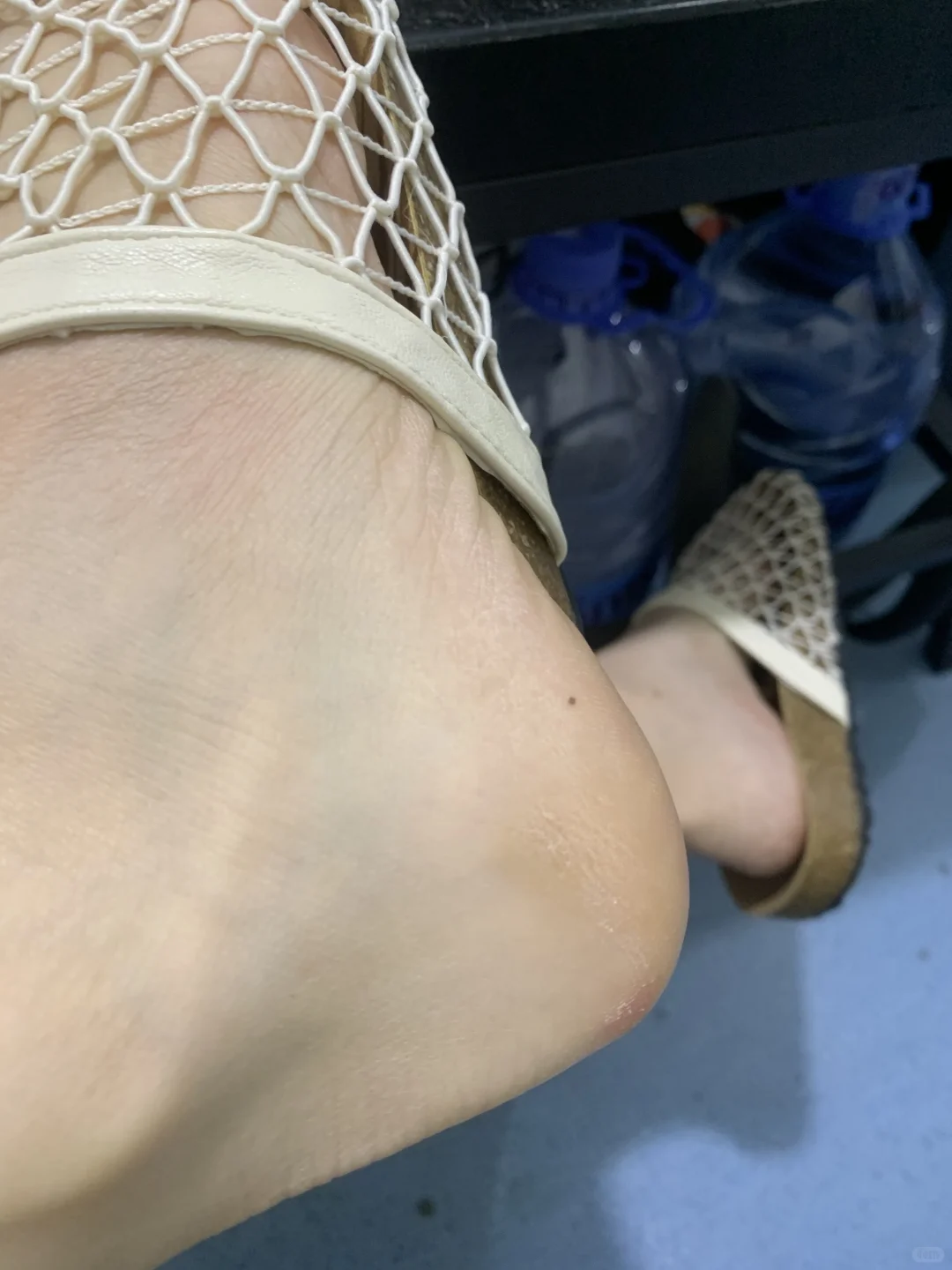 脚后跟干裂?一搓滑溜太治愈