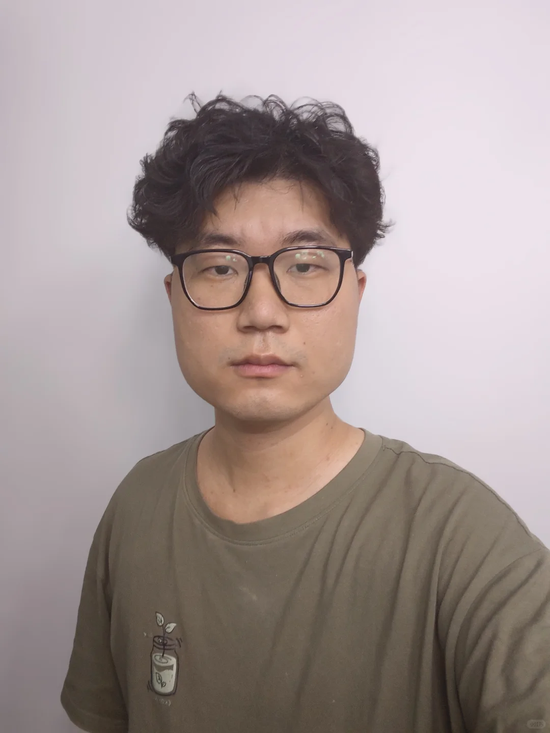 瘦脸针大概一个月的效果~