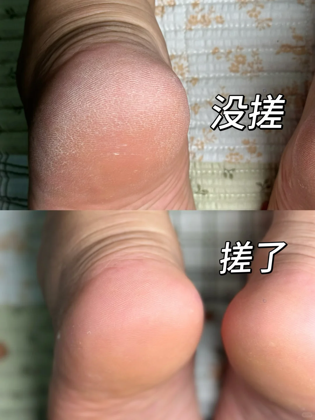 告别干裂脚！激动鼠了~