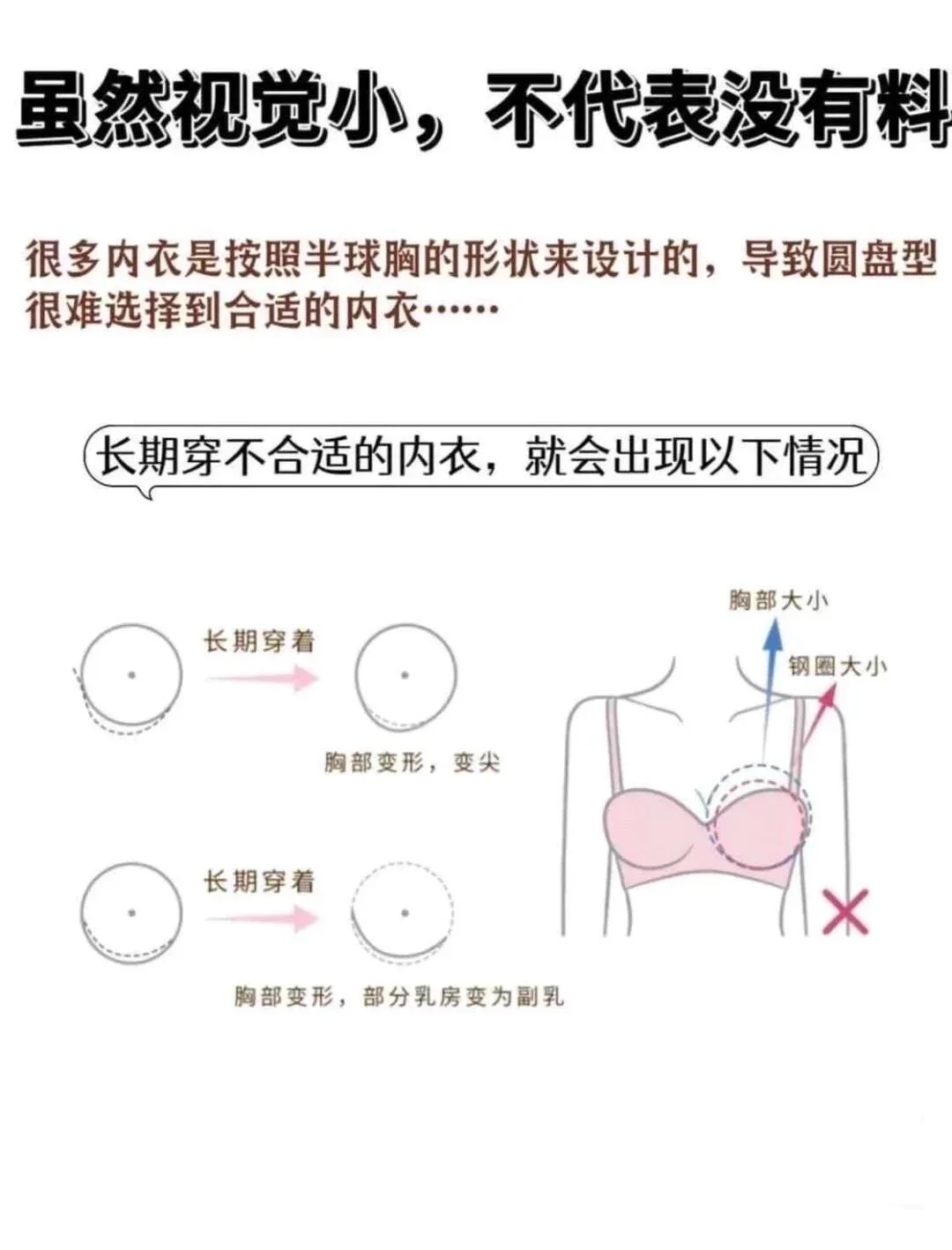 疑惑多年终于确认了自己是圆盘胸……后续